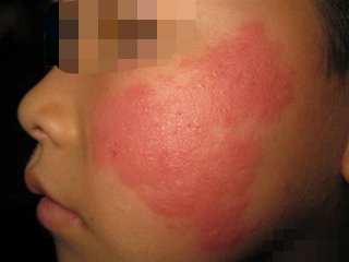 嘘！小友君悄悄告诉你我的隐藏身份――成都市化妆品不良反应监测哨点