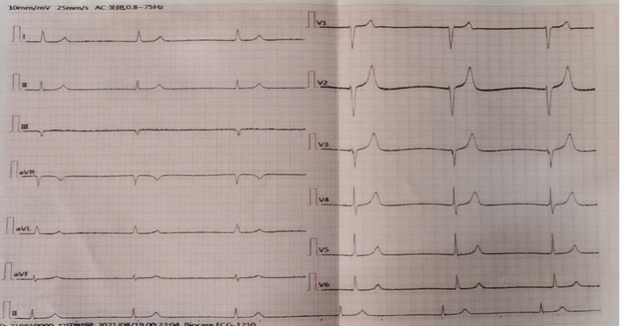 夜班故事之与死神赛跑